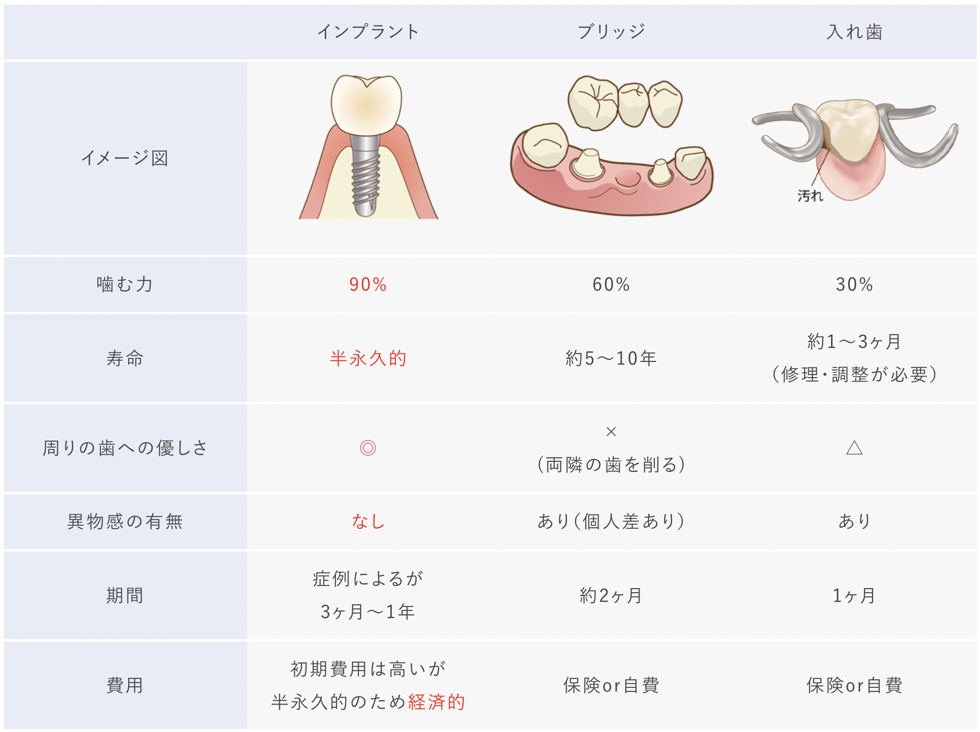 インプラント・ブリッジ・入れ歯の比較