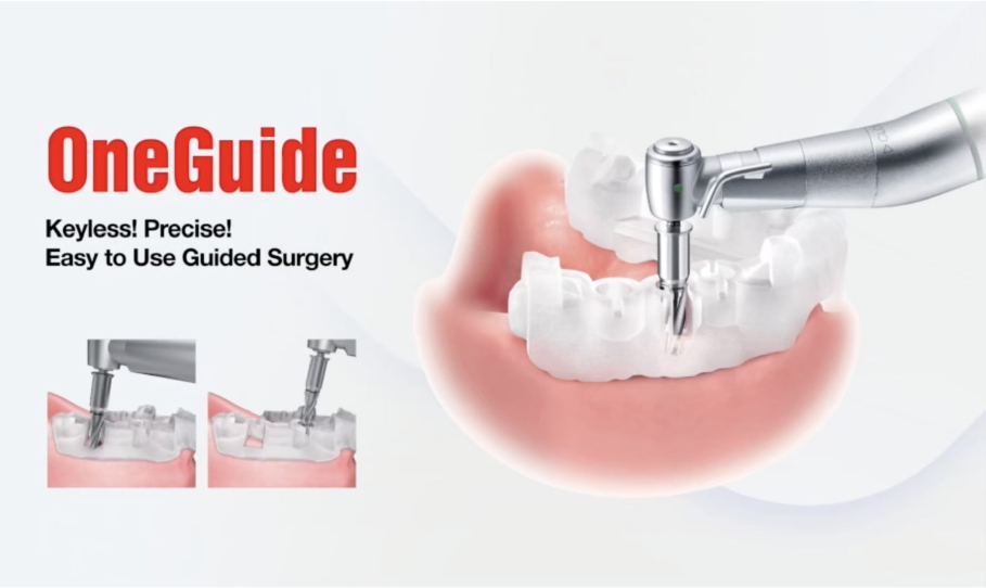 デジタルインプラント・「ワンガイド」システム